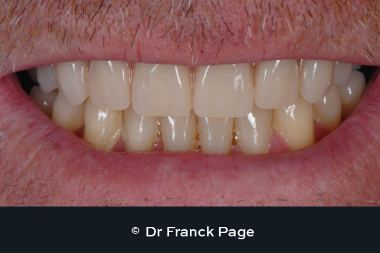 Dr Franck Page - Dental Implants