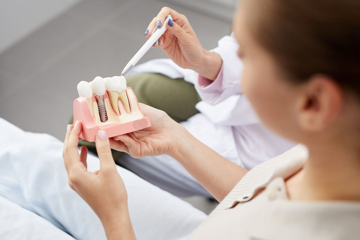 Replacing a Missing Tooth