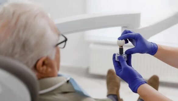 Peri-Implantitis: Causes, Prevention and Treatment