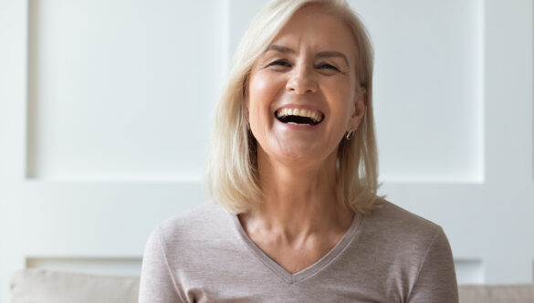 All-on-X vs Traditional Implants