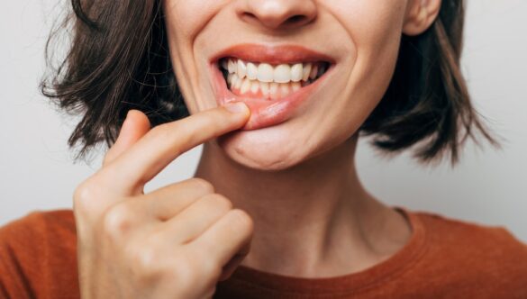 Gum Disease Uncovered