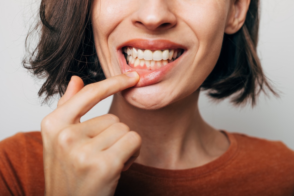 Gum Disease Uncovered: When Should You See a Periodontist?