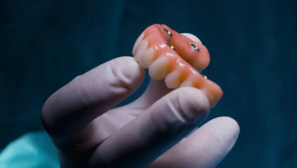 What Is a Prosthodontist?
