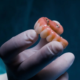What Is a Prosthodontist?